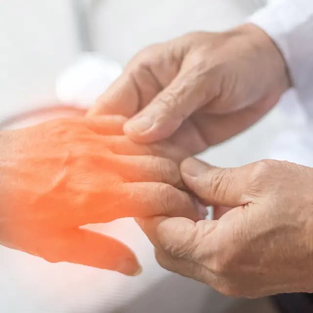Recommendations Developed for Diabetic Sensorimotor Polyneuropathy